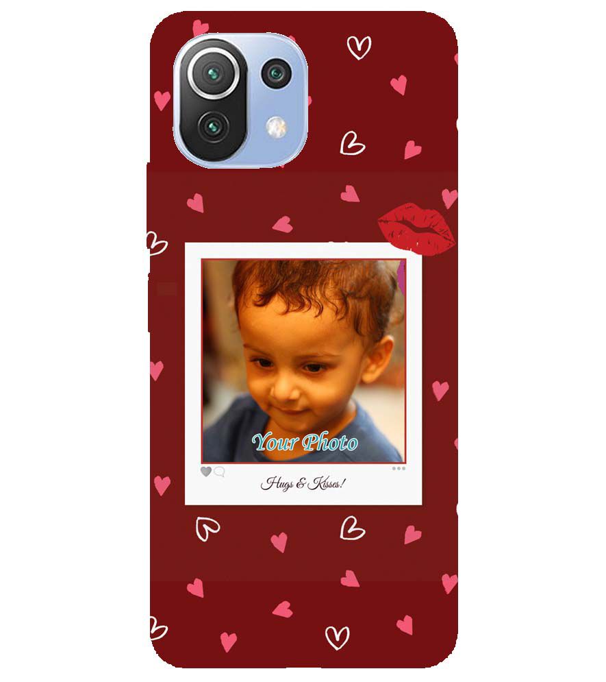 A0502-Hugs n Kisses Back Cover for Xiaomi Mi 11 Lite