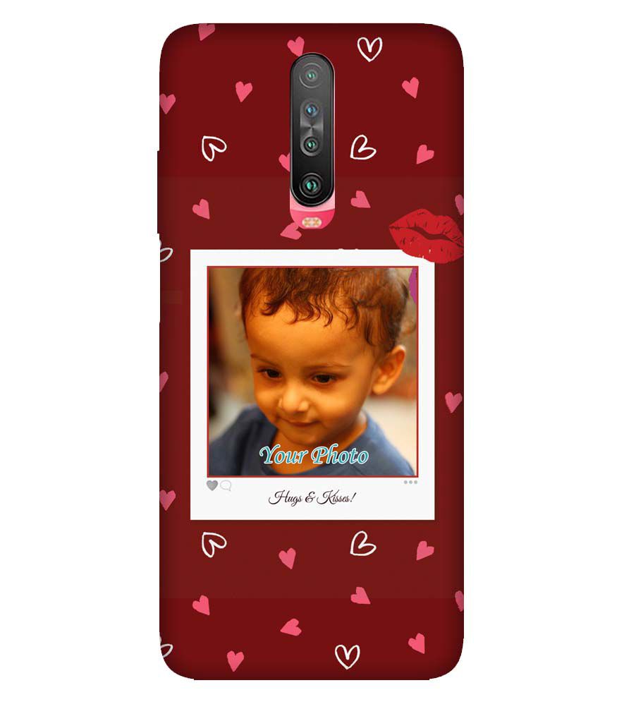 A0502-Hugs n Kisses Back Cover for Xiaomi Poco X2