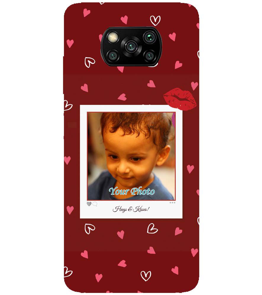 A0502-Hugs n Kisses Back Cover for Xiaomi Poco X3 Pro