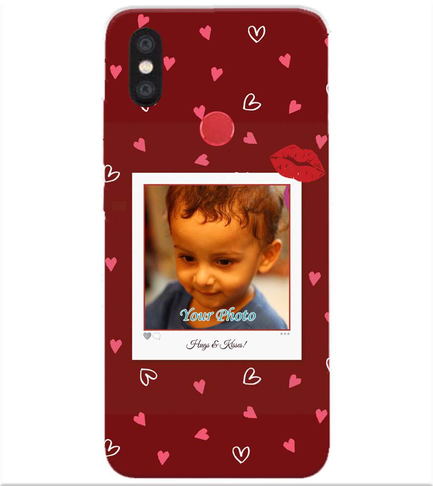 A0502-Hugs n Kisses Back Cover for Xiaomi Redmi Y2